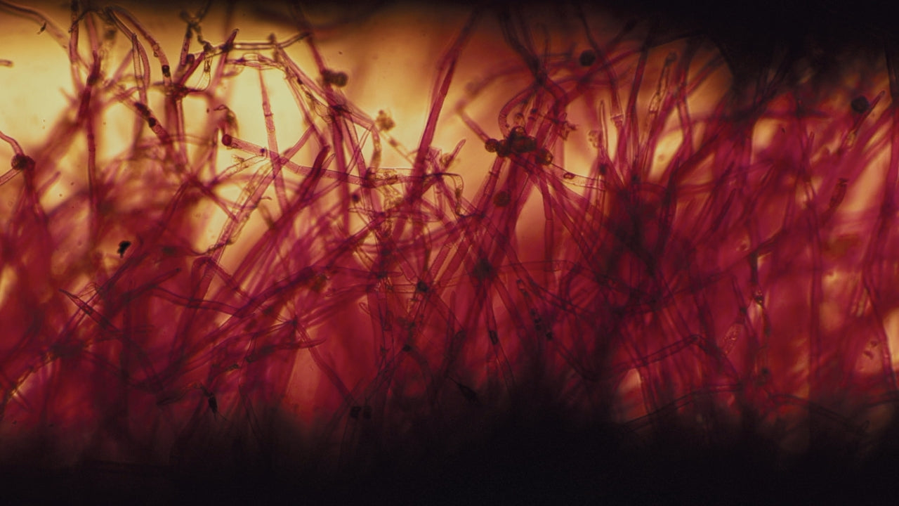 Microscopic view of hair fibers used to represent scientific scalp and hair analysis.