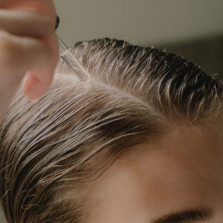Professional scalp treatment being applied during a trichology consultation.